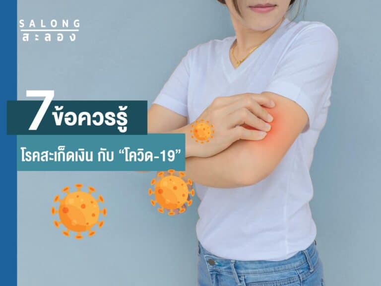 7-ข้อควรรู้-สะเก็ดเงิน-กับ-โควิด-19-บทความ